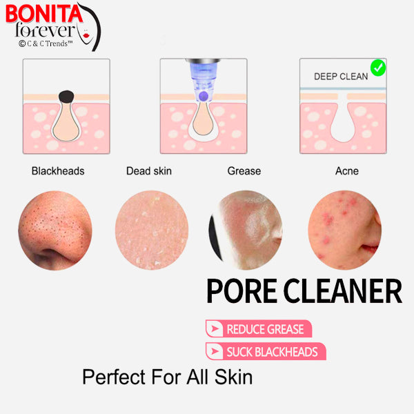 Black Spot Suction Facial Pore Cleaner 5